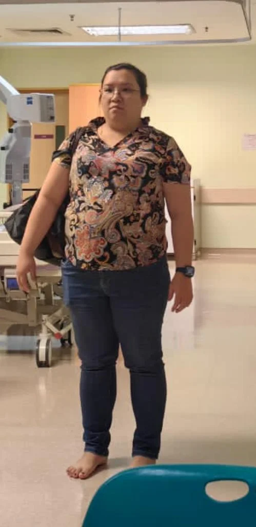 Vanessa before transformation back view showing weight